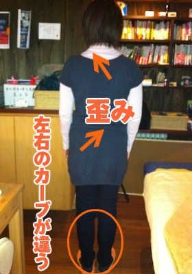 画像で歪みチェック