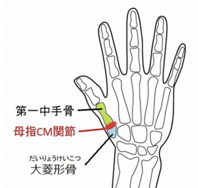 母指CM関節症の場所