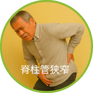 脊柱管狭窄症