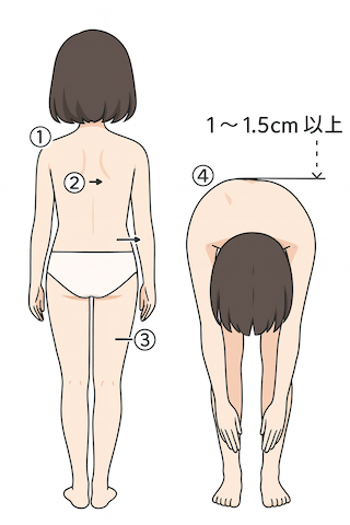 側わん症のチェック法